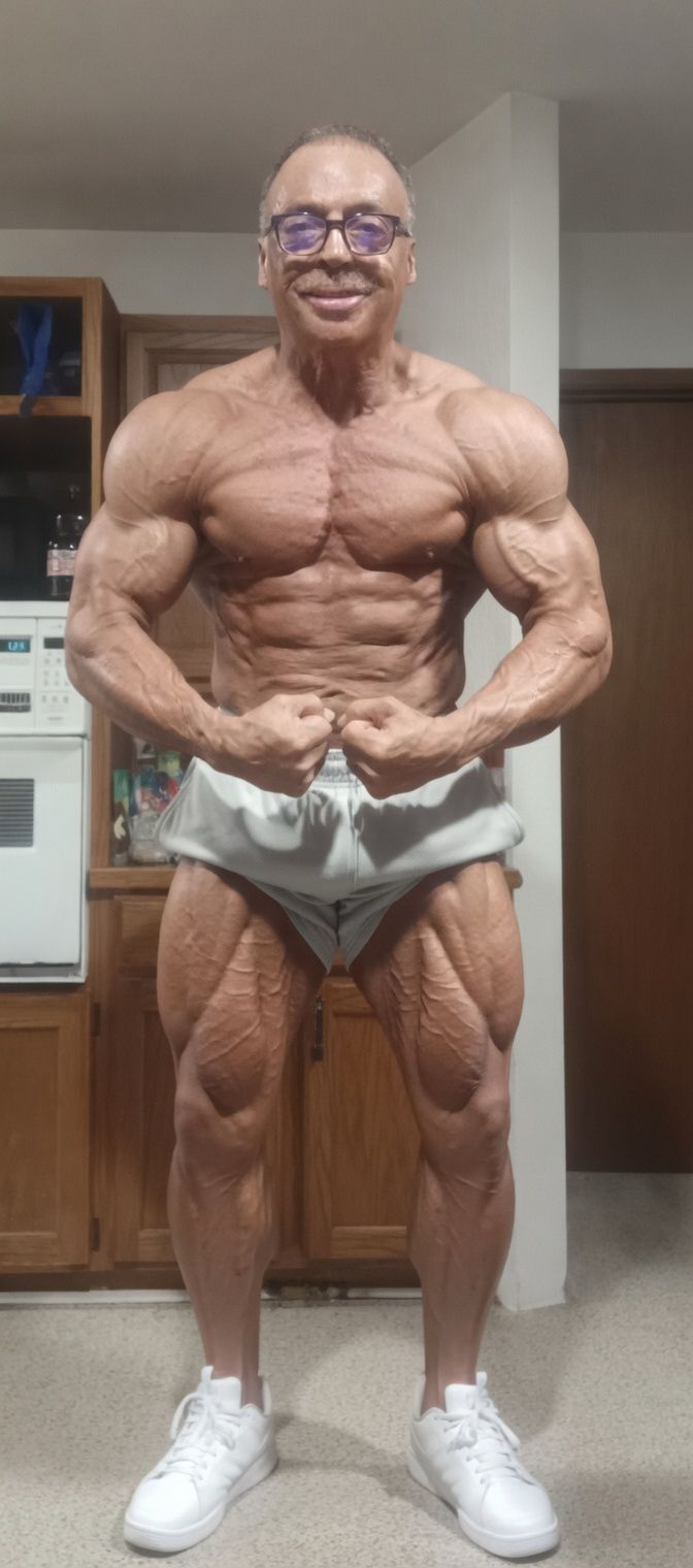 Scott Wolt — competitive bodybuilder at age 64, 38 years after surviving 80%+ body burns